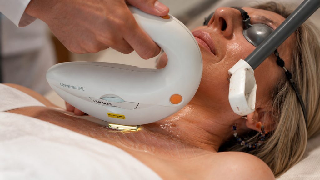 Tratamiento IPL en Dermadenia